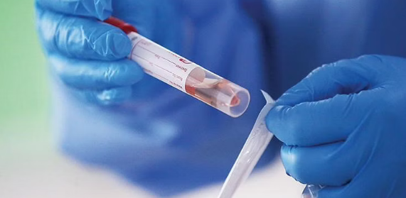 كوريا الجنوبية تسجل أكثر من 264 ألف إصابة بكورونا و339 وفاة