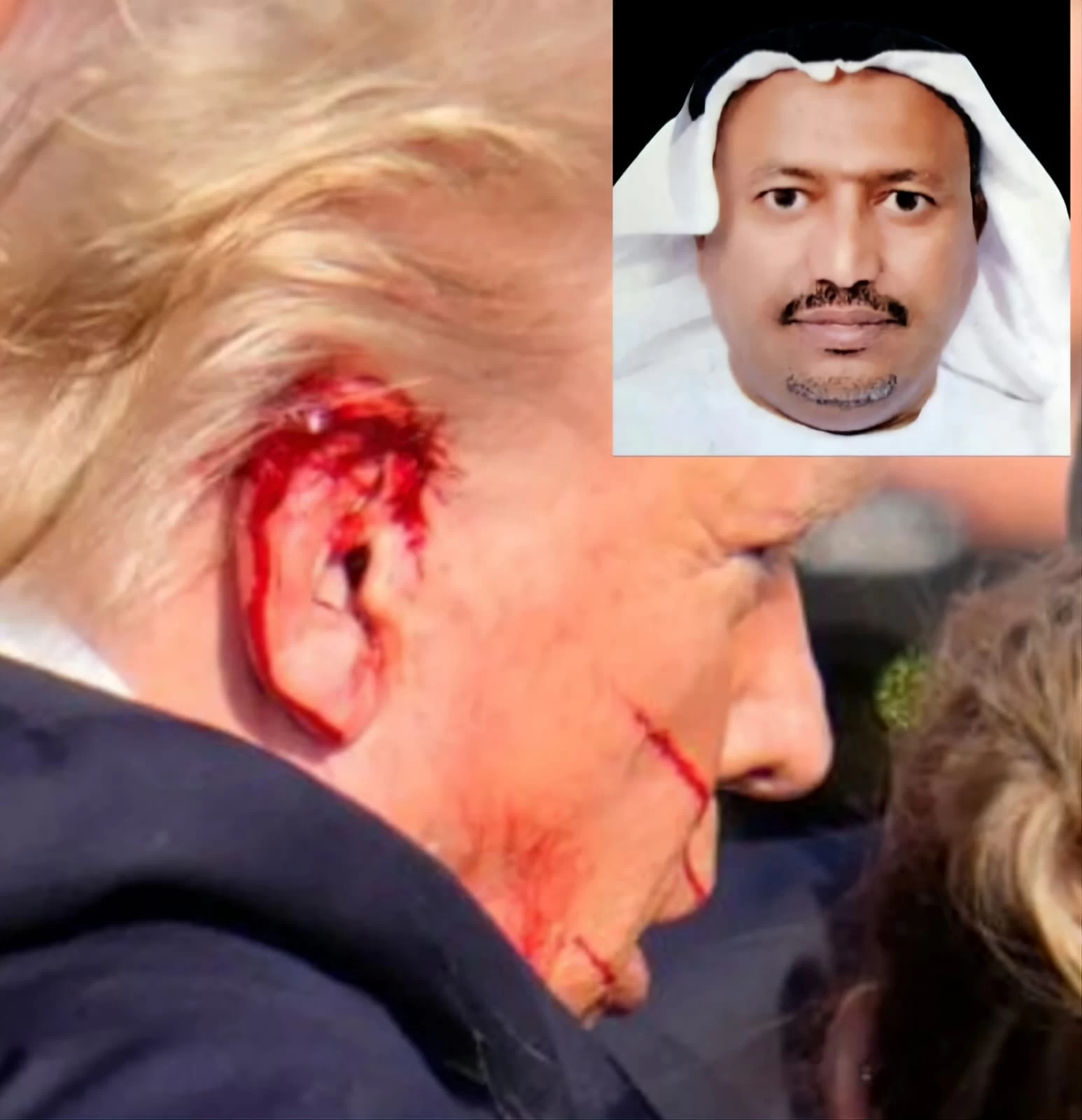 أُذُن ترمب .... هل تكون الإذن له بدخول البيت الأبيض مجدداً؟!؟