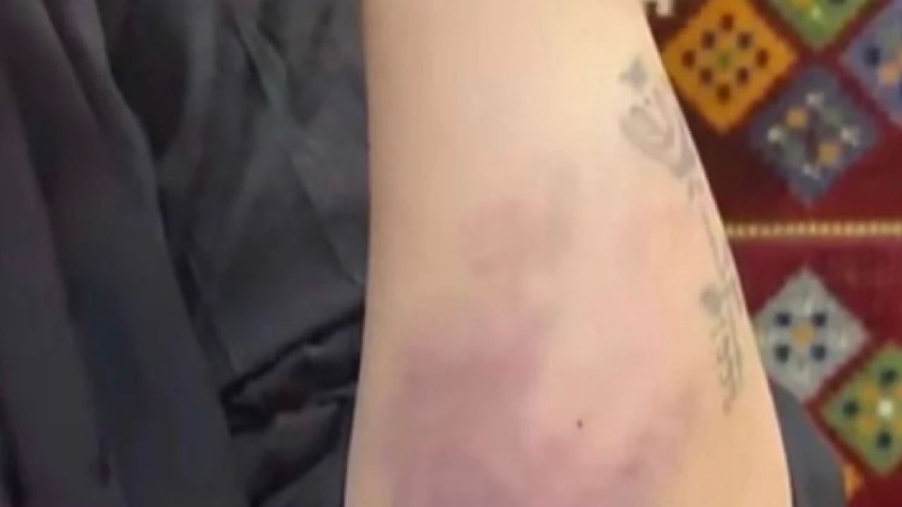 “العنف الأسري” يباشر الواقعة المتداولة حول تعرُّض امرأة للتعنيف