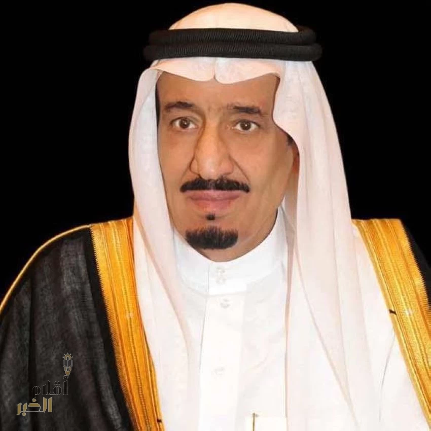انطلاق المؤتمر الدولي للتوائم الملتصقة الأحد القادم 