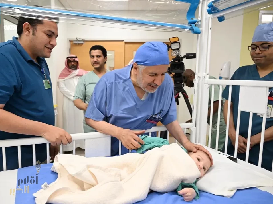 بدء عملية فصل التوأم الطفيلي المصري محمد عبدالرحمن جمعة