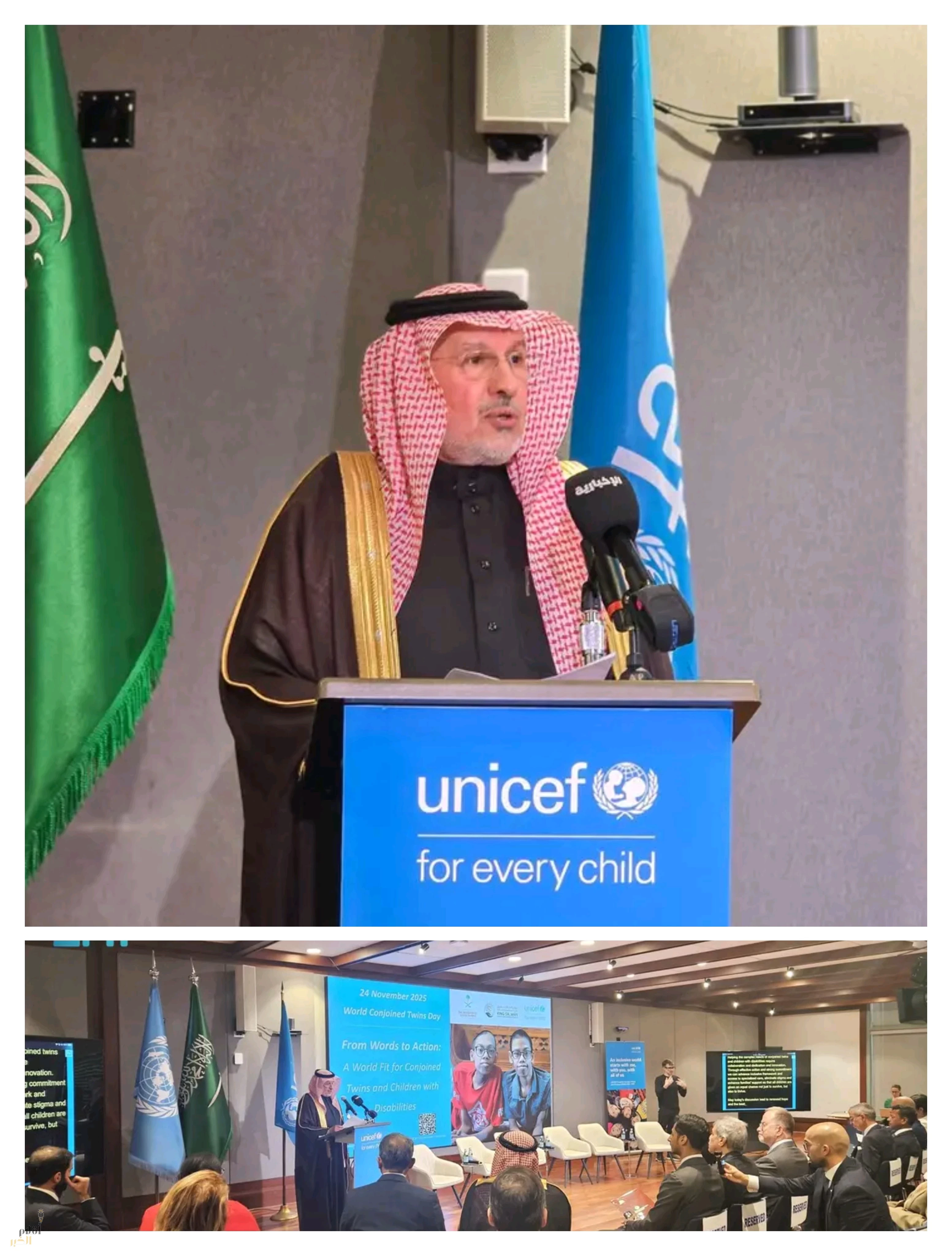 الربيعة:حماية حقوق التوائم الملتصقة ودمجهم مجتمعيًا أولوية للمملكة.