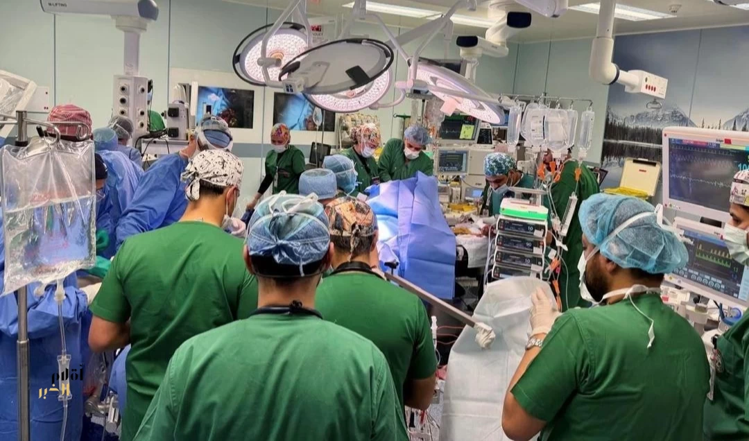 بعد قرابة 13 ساعة متواصلة.. نجاح عملية فصل التوأم الملتصق الفلبيني "كليا وموريس آن" بعد عملية جراحية معقدة