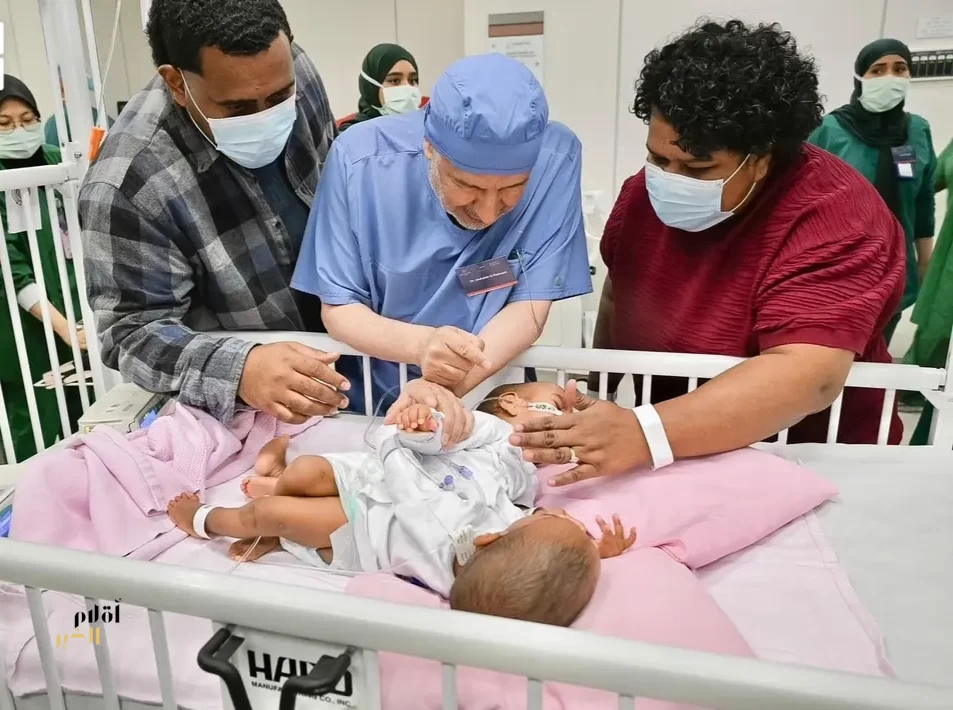 إنفاذًا لتوجيهات خادم الحرمين الشريفين وسمو ولي العهد.. بدء عملية فصل التوأم الملتصق الفيجي "جسبيلي وديسيسيا" بالرياض