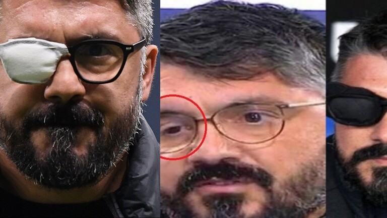 وسائل إعلام زعمت أنه سيموت بعد شهر.. غاتوزو يؤكد معاناته من مرض نادر